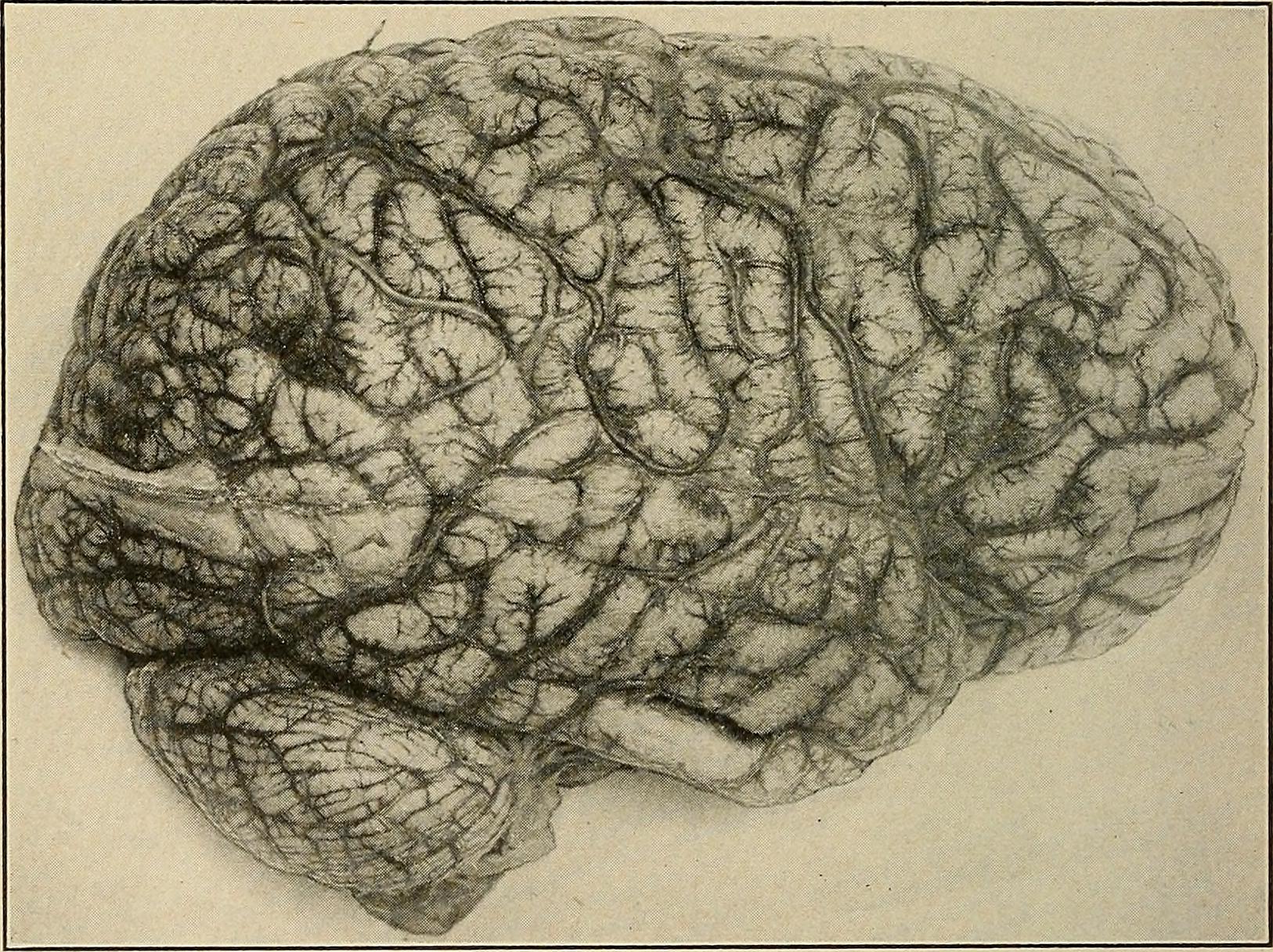 psychiatry